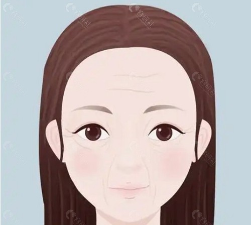 什么是面部筋膜提升三件套？