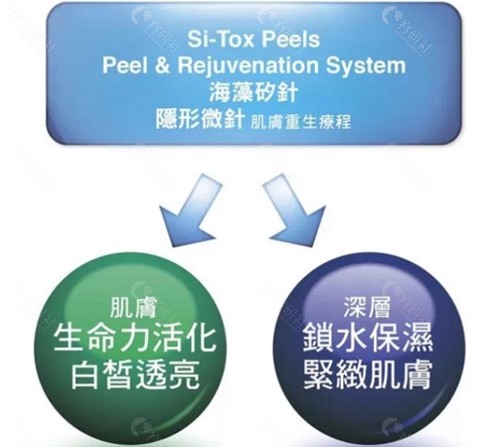 海藻汐针的原理是什么？