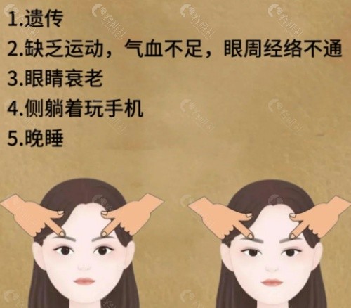 眼睛肌无力