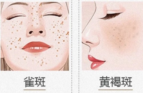 揭阳保丽圣美医疗美容祛斑好吗