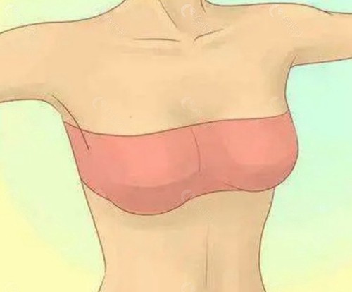 缩胸手术是否会影响哺乳功能？