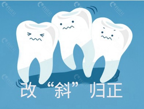 金属自锁和非自锁哪个矫正成效好