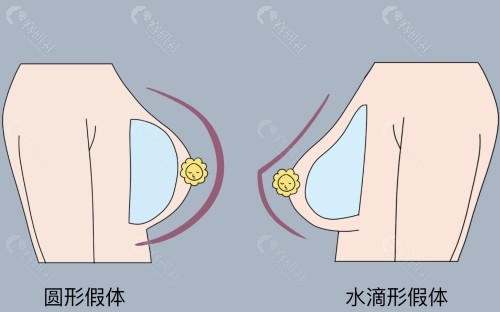 德美假体隆胸价格是多少？
