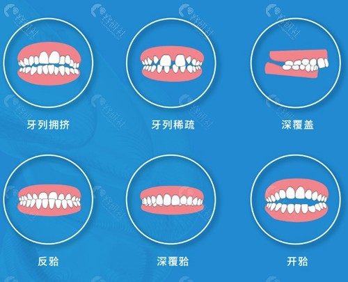 牙齿矫正失败了还能重新做吗？