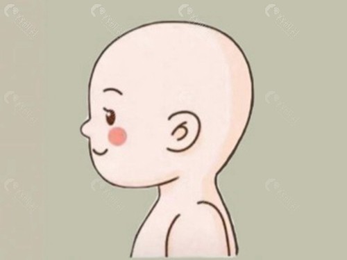 术后是否留疤的决定因素