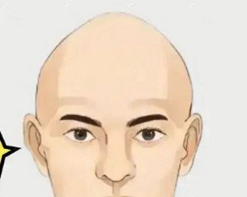 手术成效与疤痕的关系