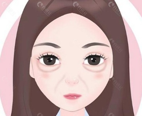 台州口碑较好的泪沟填充医院名单