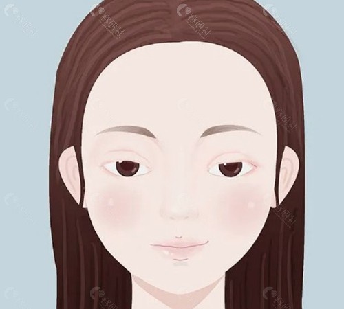 为什么做了眼综合后眼睛还是小？