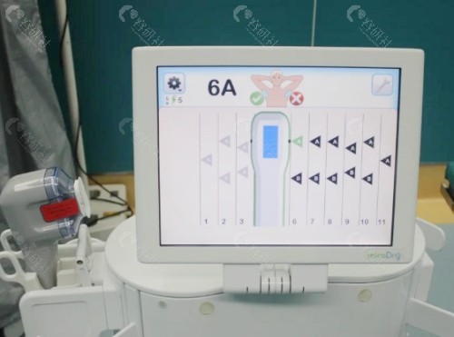 威特顿智能技术除腋臭可靠吗？多少钱？