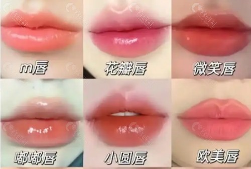 自体脂肪丰唇和玻尿酸哪个好？