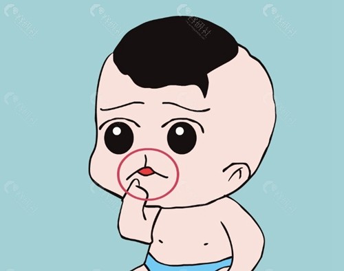 兔唇修复后疤痕的形成原因