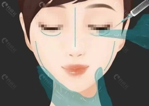 溶解酶会不会导致皮肤松弛