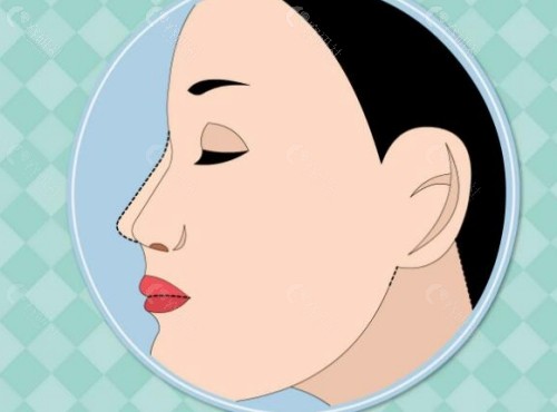 重庆隆鼻好的医生是谁？