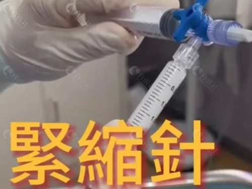 打紧缩针和紧缩手术哪个好