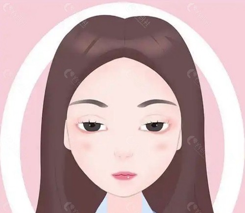 上睑下垂额肌瓣悬吊术是什么原理？