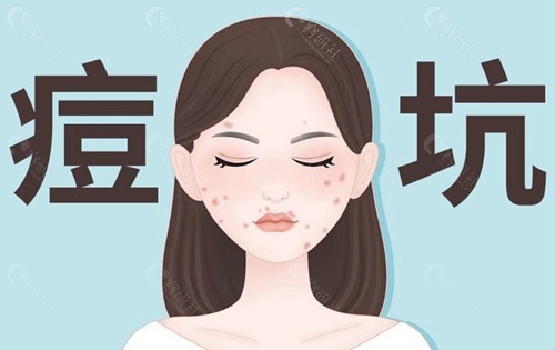环钻手术的麻醉方式