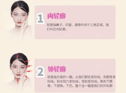 内轮廓和外轮廓固定区别在哪？