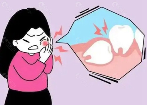 智齿烂了大窟窿到底要不要拔？