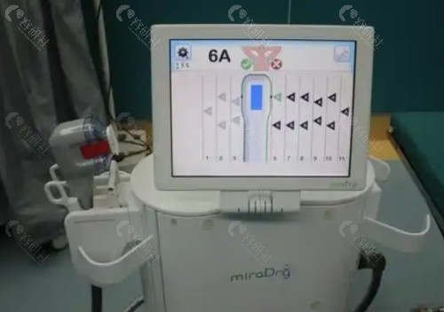 miradry微波腋臭做一次就能好吗？适合哪些人群？