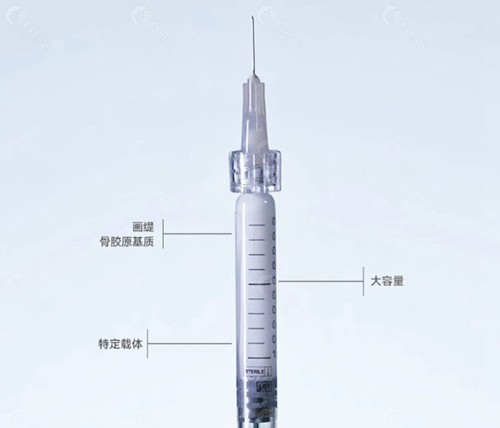 注射画缇轮廓针后多久可以看到鼻子的变化？