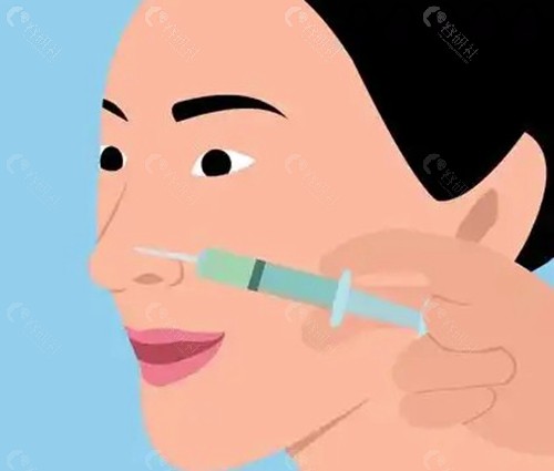 爱贝芙注射隆鼻几天形状稳定？