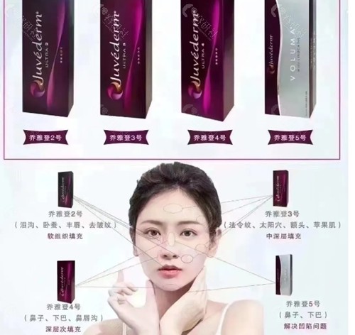 乔雅登玻尿酸隆鼻维持时间