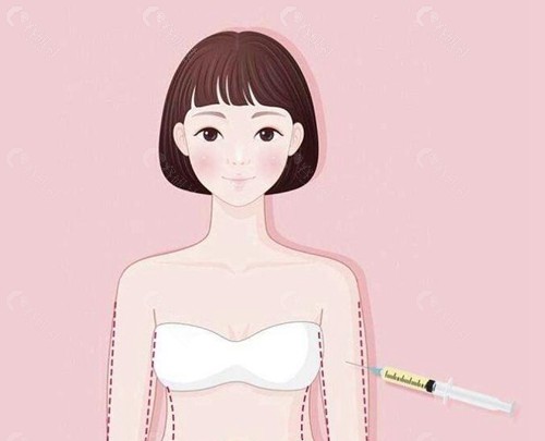 胸部奥美定取出后多久可以做自体脂肪丰胸？