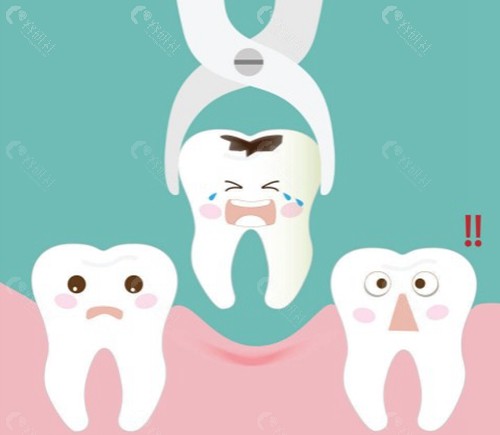 宁愿拔牙不做根管治疗是怎么回事