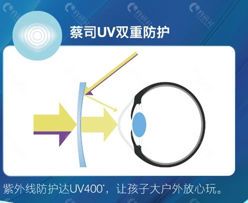 蔡司近视防控眼镜好吗