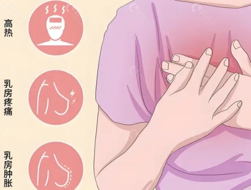哪些乳房肥大可以做乳房缩小手术？