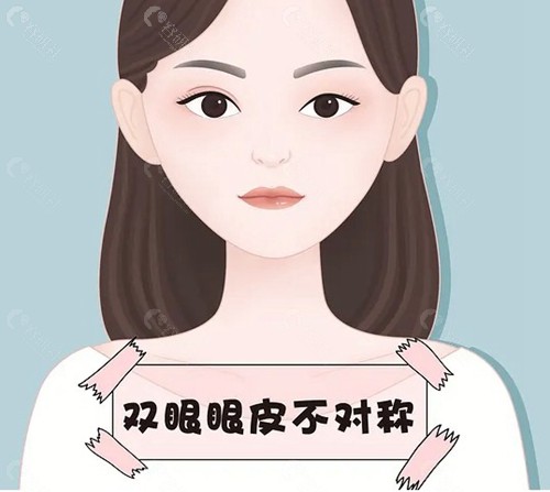 双眼皮修复王振军好还是韩勋好