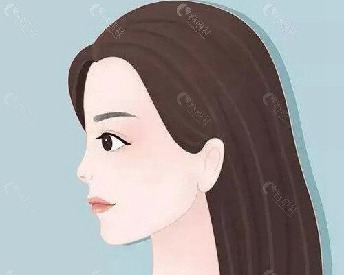 鼻子假体取出后多久可以进行鼻修复？