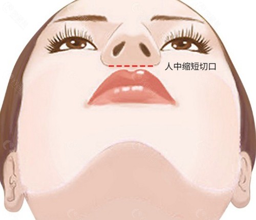 李辉医生