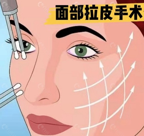 微拉美5.0和4.0有什么区别？