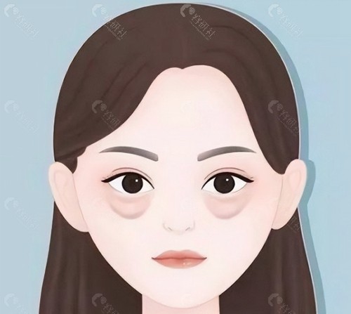 眼袋打了溶脂针反而越来越大正常吗