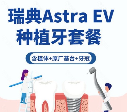 瑞典astra种植牙属于什么档次？