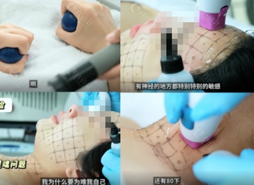 中山热玛吉收费价格表