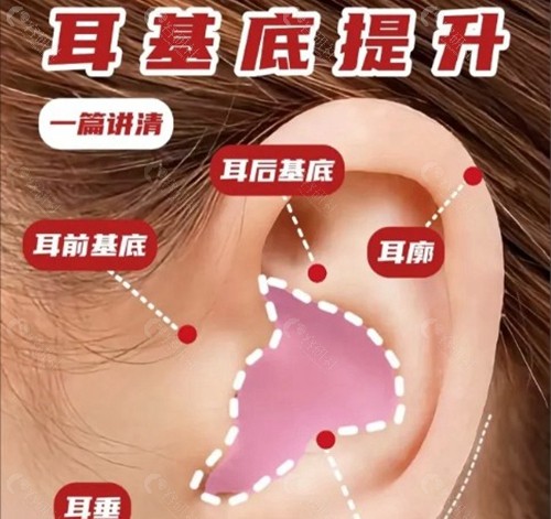耳基底韧带提升的基本原理