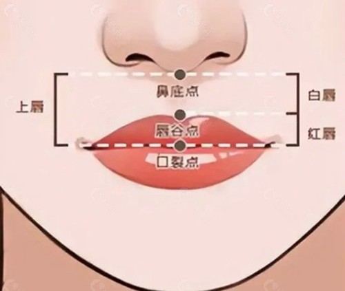 人中缩短术后三个月仍有牵扯感是否正常？