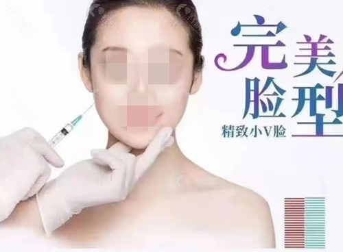 一针降颧骨能维持多久