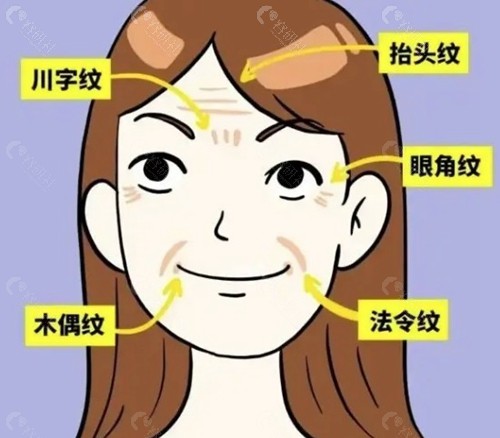 李运峰