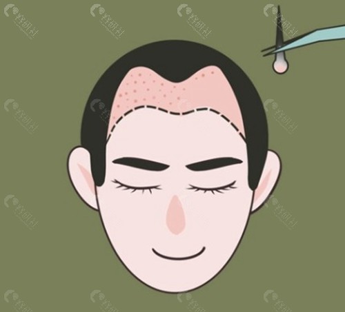 新生不同技术的价格差异