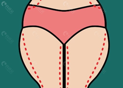郑京恒医生技术特色与患者反馈