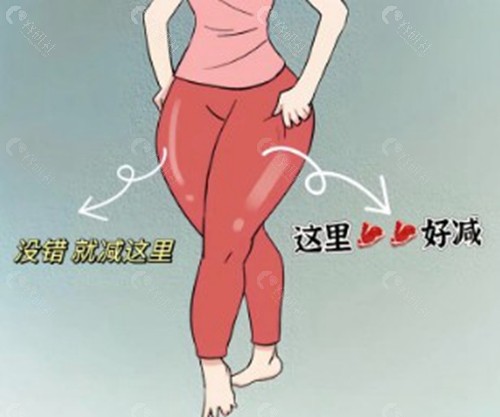 大腿抽脂10斤一般要多少钱？