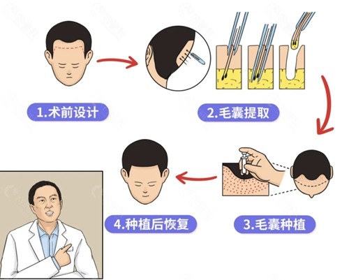 南京初禾植发怎么样