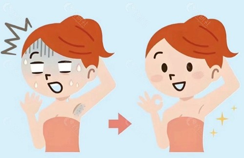 深圳 Miradry 微波治疗腋臭医生排名及技术特色