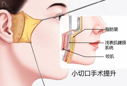 赵延峰医生