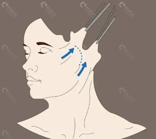 朱婷君医生