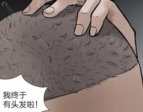 滨州熙朵华美植发好吗
