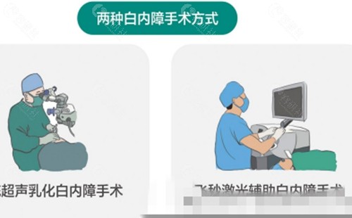 肇庆民生眼科医院做白内障好吗